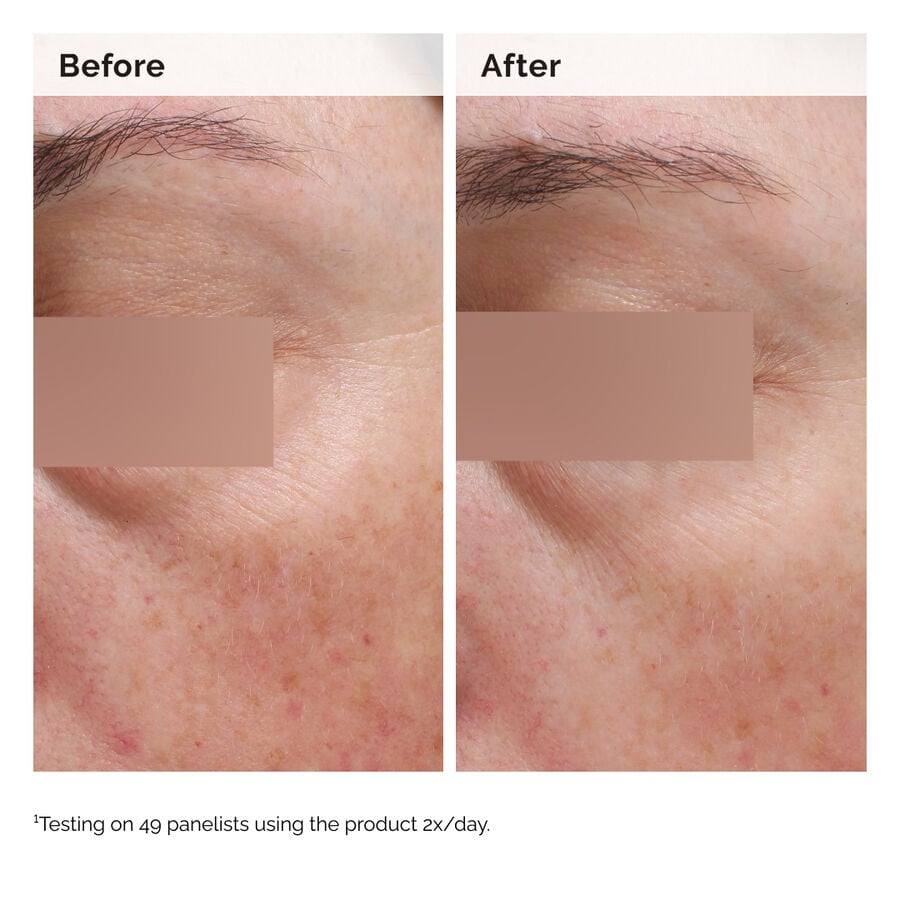 niacinamide-5-face-and-body-emulsion-v7 2024-08-23-ORD-Nia-5pct-Face-Body-B-A-Elasticity-Global-02-1x1.jpg