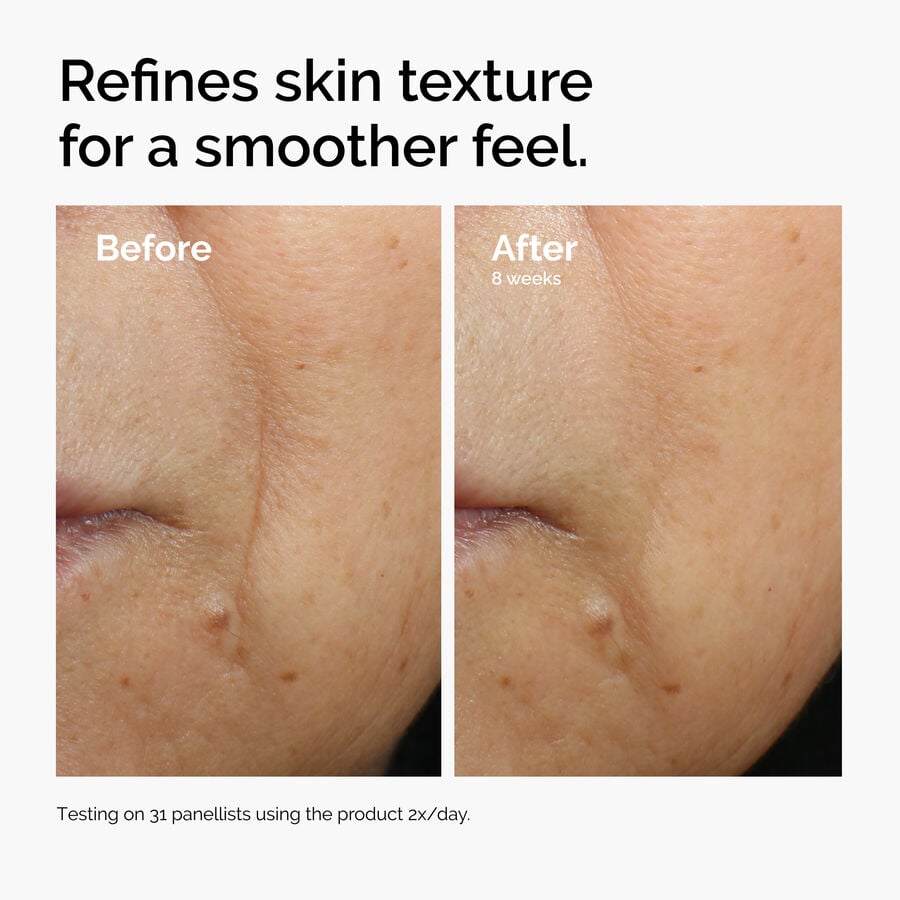 caffeine-3-escin-1-face-serum-n4 ord-caffeine-3pct-escin-1pct-face-serum-before-after-texture.jpg